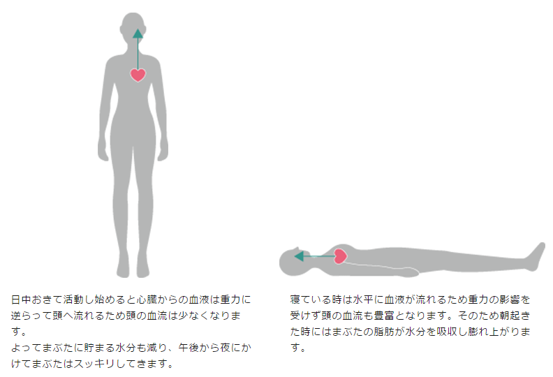 むくみ