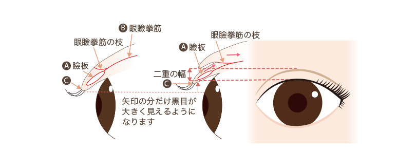 二重のしくみ