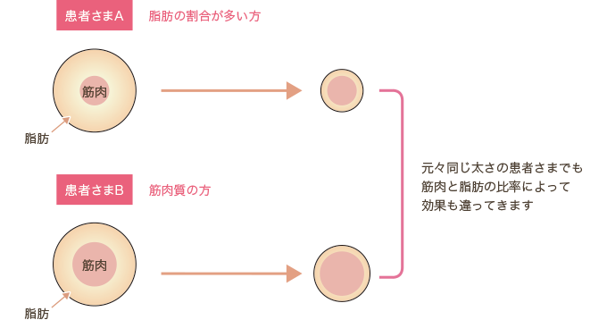 脂肪吸引のイラスト１【20161117】