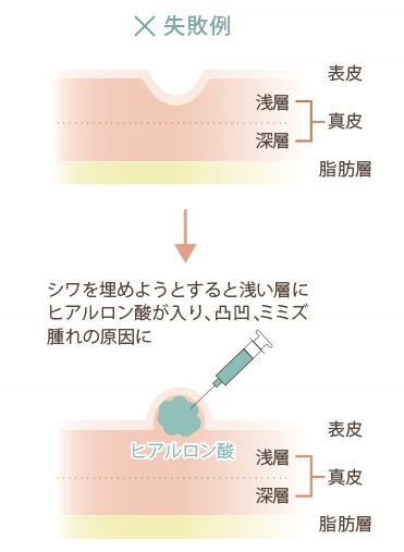 失敗例