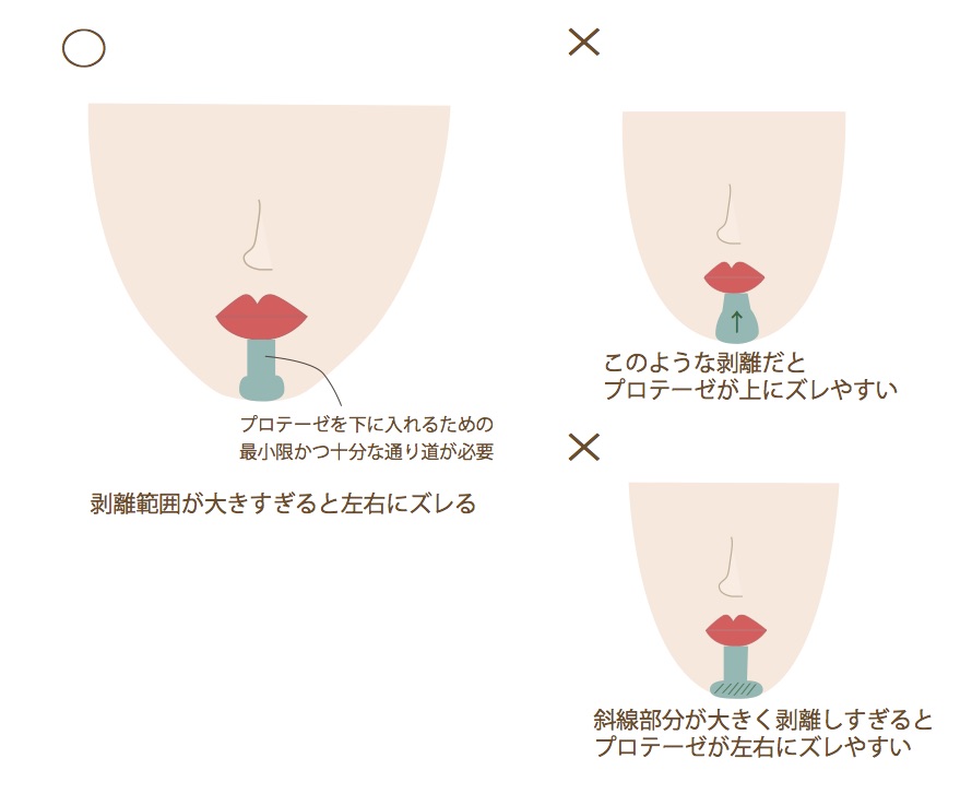 ago図４ (1)